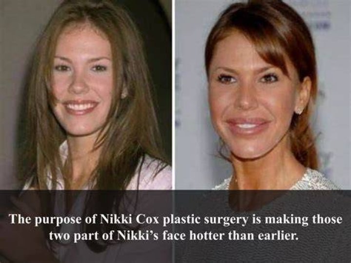 Nikki Cox Lip Augmentation Plastic Surgery Before and After